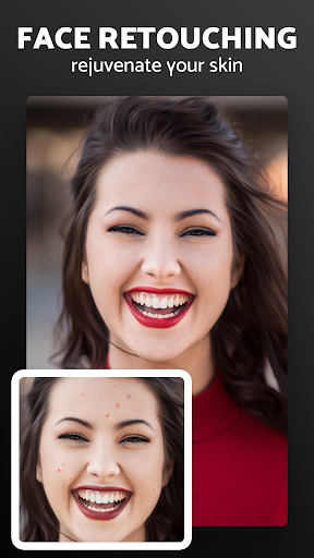 Pixl - Face Retouch & Blemish 